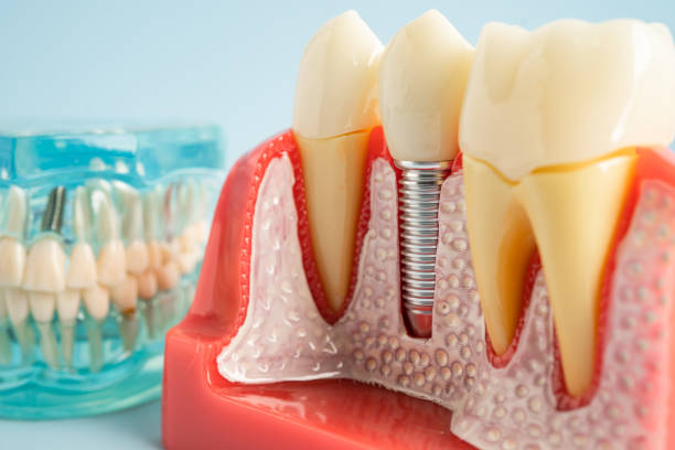 Our Range of Dental Services in Auburn, KS